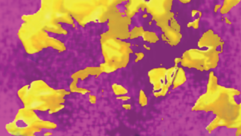 Concerts a benefici de la Fundació Autisme Mas Casadevall