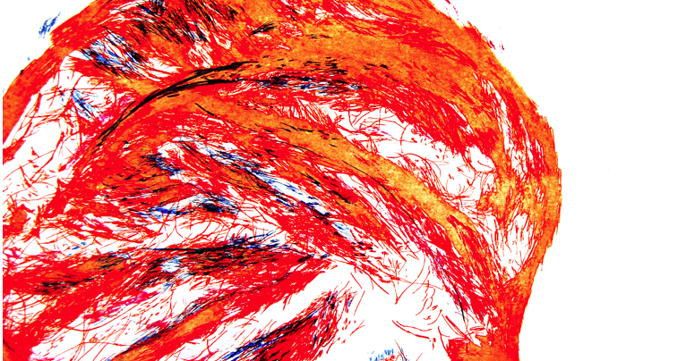 La Biennal d\'Art Contemporani Català a la Societat l\'Amistat