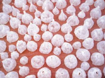 Maternitat, fragilitat i resistència a les dues exposicions de la Casa Elizalde