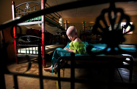 Liron Shimoni prepara una exposició sobre l\'albinisme a la Galeria H2O