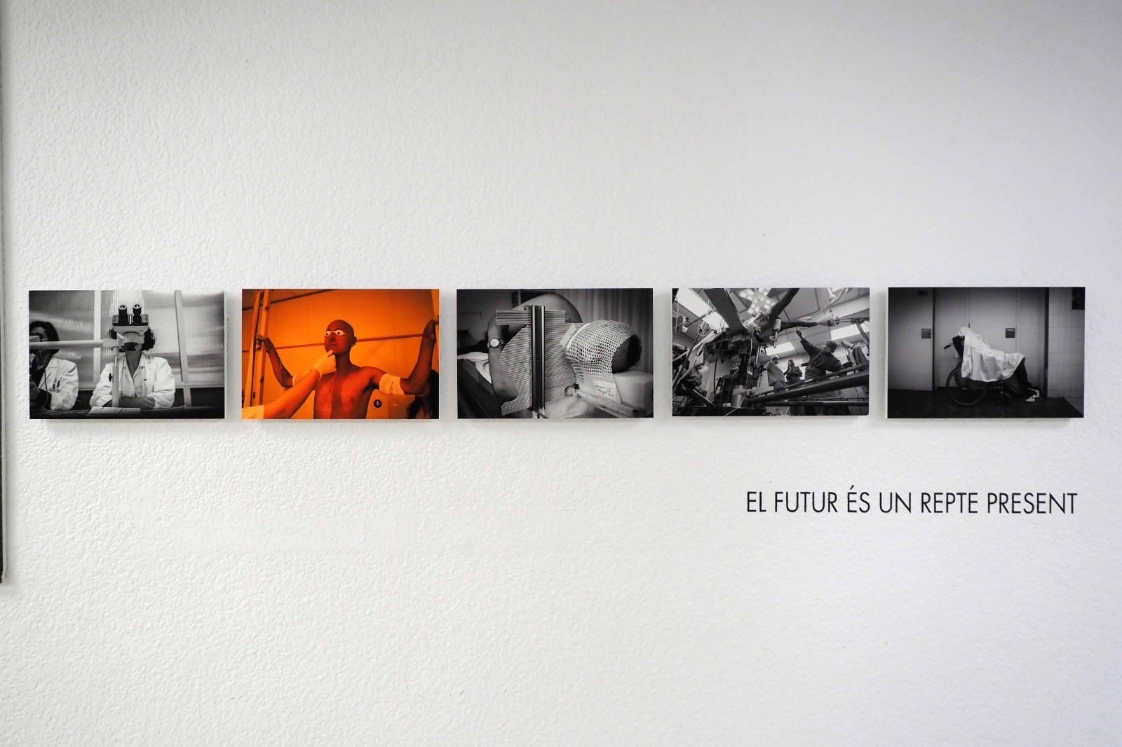 Tino Soriano and the health photography of "CURART" are exhibited at the Josep Trueta Hospital