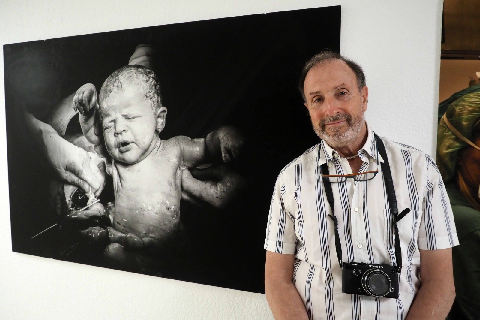 Tino Soriano y la fotografía sanitaria de "CURART" se exhiben en el Hospital Josep Trueta